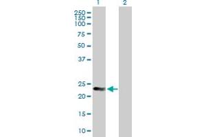 Western Blot analysis of MAD2L2 expression in transfected 293T cell line by MAD2L2 MaxPab polyclonal antibody. (MAD2L2 antibody  (AA 1-211))