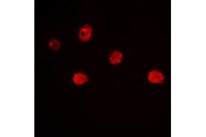 Immunofluorescent analysis of MYF5 staining in Jurkat cells. (MYF5 antibody  (Center))