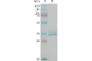 CGRP Protein (AA 83-119) (Fc Tag)