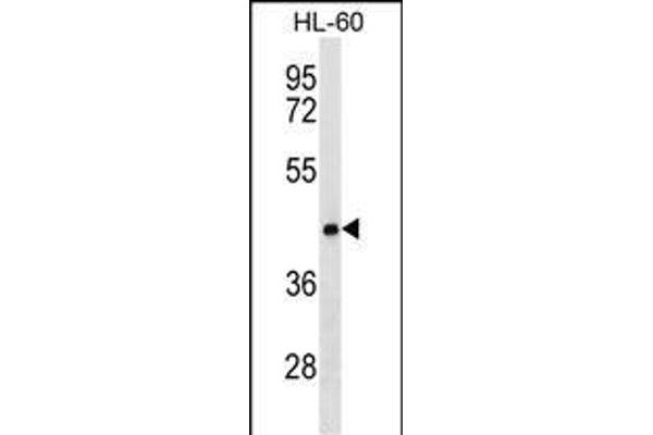 CLN8 anticorps  (C-Term)