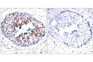 Immunohistochemistry (IHC) image for anti-Signal Transducer and Activator of Transcription 5A (STAT5A) (pSer780) antibody (ABIN2888533) (STAT5A antibody  (pSer780))