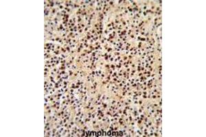 Immunohistochemistry (IHC) image for anti-Lymphocyte-Specific Protein tyrosine Kinase (LCK) antibody (ABIN3001655) (LCK antibody)