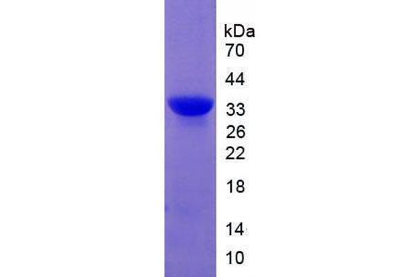 CAPNL1 Protein (AA 387-694) (His tag)