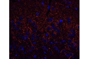 Immunohistochemistry (Paraffin-embedded Sections) (IHC (p)) image for anti-Tubulin, beta 3 (TUBB3) (AA 443-450) antibody (ABIN1742553)