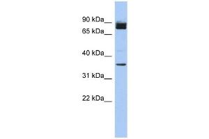 MGC48628 antibody used at 1 ug/ml to detect target protein. (MGC48628 (N-Term) antibody)