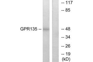 Western Blotting (WB) image for anti-G Protein-Coupled Receptor 135 (GPR135) (C-Term) antibody (ABIN1852986) (GPR135 antibody  (C-Term))