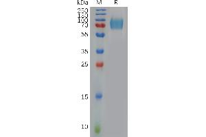 IFNAR1 Protein (AA 28-436) (His tag)