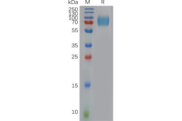 IFNAR1 Protein (AA 28-436) (His tag)