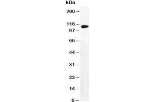 Western blot testing of DPYD antibody and MM231 cell lysate (DPYD antibody  (AA 33-52))