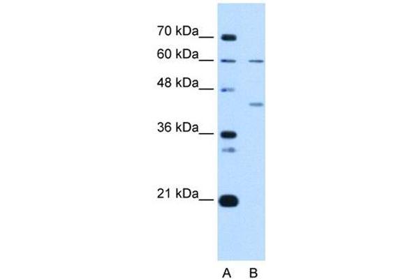 RFC5 antibody