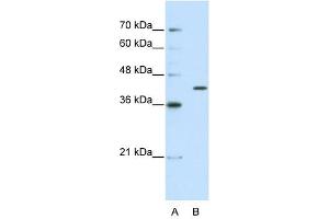 THEX1 antibody used at 2. (ERI1 antibody  (C-Term))