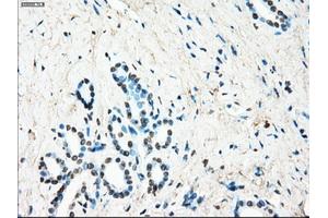 Immunohistochemical staining of paraffin-embedded Ovary tissue using anti-LTA4H mouse monoclonal antibody. (LTA4H antibody)