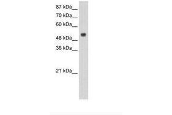 RBM45 antibody  (N-Term)