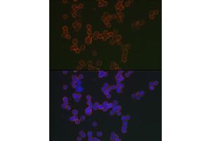 Immunofluorescence analysis of Raji cells using CD20 Rabbit pAb (ABIN7268473) at dilution of 1:150 (40x lens). (CD20 antibody  (AA 208-297))