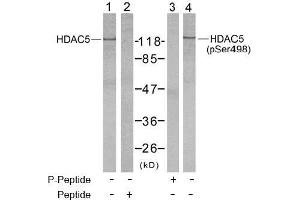 Image no. 2 for anti-Histone Deacetylase 5 (HDAC5) (pSer498) antibody (ABIN196933) (HDAC5 antibody  (pSer498))