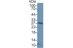 Western blot analysis of Human Placenta lysate, using Human NT3 Antibody (1 µg/ml) and HRP-conjugated Goat Anti-Rabbit antibody ( (Neurotrophin 3 antibody  (AA 21-138))