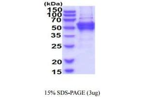 SDS-PAGE (SDS) image for Diphthamide Biosynthesis Protein 2 (DPH2) (AA 1-489) protein (His tag) (ABIN6388024) (DPH2 Protein (AA 1-489) (His tag))