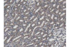 DAB staining on IHC-P; Samples: Mouse Kidney Tissue. (Interferon gamma antibody  (AA 23-155))