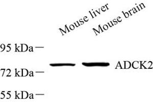 Western blot analysis of ADCK2 (ABIN7072872) at dilution of 1: 500 (ADCK2 antibody)