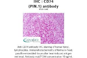 Image no. 1 for anti-HLA-DR-gamma (CD74) antibody (ABIN5693517) (CD74 antibody)