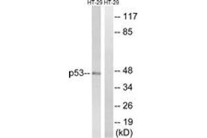 Western blot analysis of extracts from HT-29 cells, treated with calyculinA 50ng/ml 30', using p53 (Ab-376) Antibody. (p53 antibody  (AA 334-383))