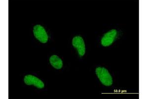 Immunofluorescence of purified MaxPab antibody to INTS12 on HepG2 cell. (INTS12 antibody  (AA 1-462))