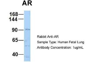 Host: Rabbit Target Name: AR Sample Type: Human Fetal Lung Antibody Dilution: 1. (Androgen Receptor antibody  (N-Term))