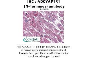 Image no. 2 for anti-Adenylate Cyclase Activating Polypeptide 1 (Pituitary) Receptor Type I (ADCYAP1R1) (Extracellular Domain), (N-Term) antibody (ABIN1731541) (ADCYAP1R1 antibody  (Extracellular Domain, N-Term))
