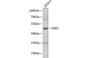 Western blot analysis of extracts of SKOV3 cells, using EGR3 antibody (ABIN6127828, ABIN6139993, ABIN6139994 and ABIN6223592) at 1:1000 dilution. (EGR3 antibody  (AA 1-250))