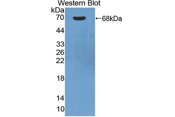 Angiostatin antibody  (AA 100-434)