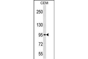 Western blot analysis in CEM cell line lysates (35ug/lane). (ADRBK2 antibody  (C-Term))