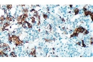 Normal human pituitary gland: immunohistochemical staining for Thyroid Stimulating Hormone. (TSH antibody)