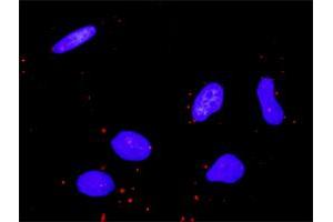 Proximity Ligation Analysis of protein-protein interactions between CDC42 and MAP3K11. (MAP3K11 antibody  (AA 741-847))