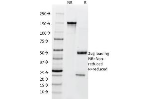 SDS-PAGE Analysis Purified BCL10 Mouse Monoclonal Antibody (SPM520). (BCL10 antibody  (AA 122-168))
