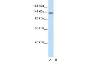 Western Blotting (WB) image for anti-Timeless Homolog (TIMELESS) antibody (ABIN2461713) (TIMELESS antibody)