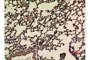 Immunohistochemical analysis of paraffin-embedded mouse-lung, antibody was diluted at 1:100. (NRF2 antibody  (acLys599))