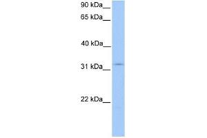 KCTD21 antibody used at 1 ug/ml to detect target protein. (KCTD21 antibody  (N-Term))