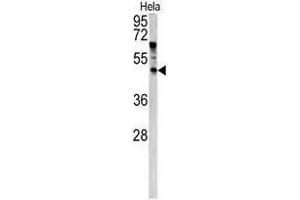 Image no. 1 for anti-Angiopoietin-Like 7 (ANGPTL7) (N-Term) antibody (ABIN452737) (ANGPTL7 antibody  (N-Term))