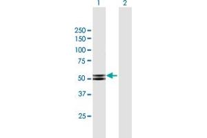 Western Blot analysis of PRKAR2B expression in transfected 293T cell line by PRKAR2B MaxPab polyclonal antibody. (PRKAR2B antibody  (AA 1-418))