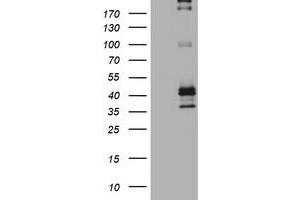 Image no. 2 for anti-Fc Fragment of IgE, Low Affinity II, Receptor For (CD23) (FCER2) (AA 48-321) antibody (ABIN1491553) (FCER2 antibody  (AA 48-321))