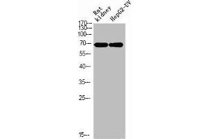 Western blot analysis of RAT-kidney HEPG2-UV using p-Ku-70 (S5) antibody. (XRCC6 antibody  (pSer5))