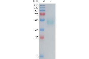 Mouse TSLP Protein, hFc Tag on SDS-PAGE under reducing condition. (Thymic Stromal Lymphopoietin Protein (TSLP) (AA 20-140) (Fc Tag))