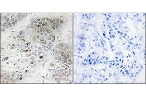 Immunohistochemistry (IHC) image for anti-Tumor Protein P53 (TP53) (pSer9) antibody (ABIN2888503) (p53 antibody  (pSer9))