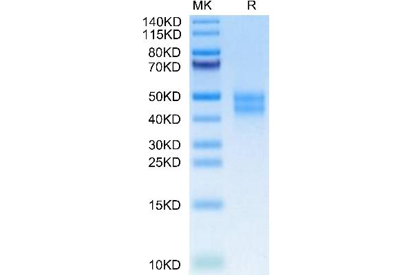 MXRA8 Protein (AA 20-340) (His tag)