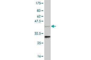 Western Blot detection against Immunogen (37. (NR4A2 antibody  (AA 147-250))