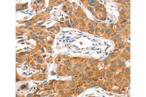 Immunohistochemistry (IHC) image for anti-NUAK Family, SNF1-Like Kinase, 1 (NUAK1) antibody (ABIN2432509) (NUAK1 antibody)