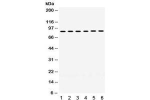 Western blot testing of 1) mouse testis, 2) rat ovary, human 3) placenta, 4) HeLa, 5) 22RV1 and 6) MCF7 lysate with LOXL2 antibody. (LOXL2 antibody)