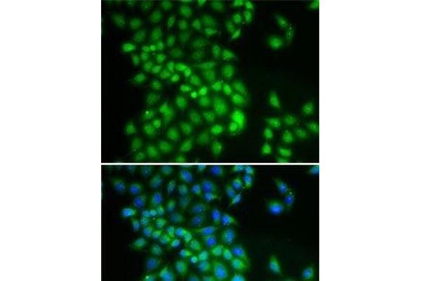 YTHDC1 antibody