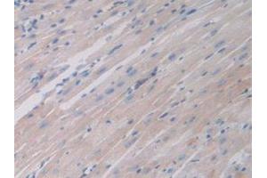 IHC-P analysis of Mouse Heart Tissue, with DAB staining. (Ferritin Mitochondrial antibody  (AA 54-229))