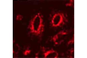 Image no. 1 for anti-Lysosomal-Associated Membrane Protein 1 (LAMP1) antibody (ABIN466916) (LAMP1 antibody)